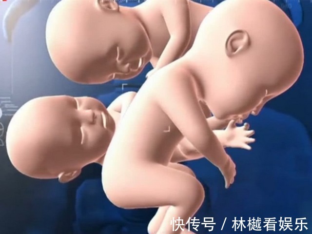 产房|孕妇怀四胞胎以为是儿子,结果生四个女儿,爸爸产房外手舞足蹈