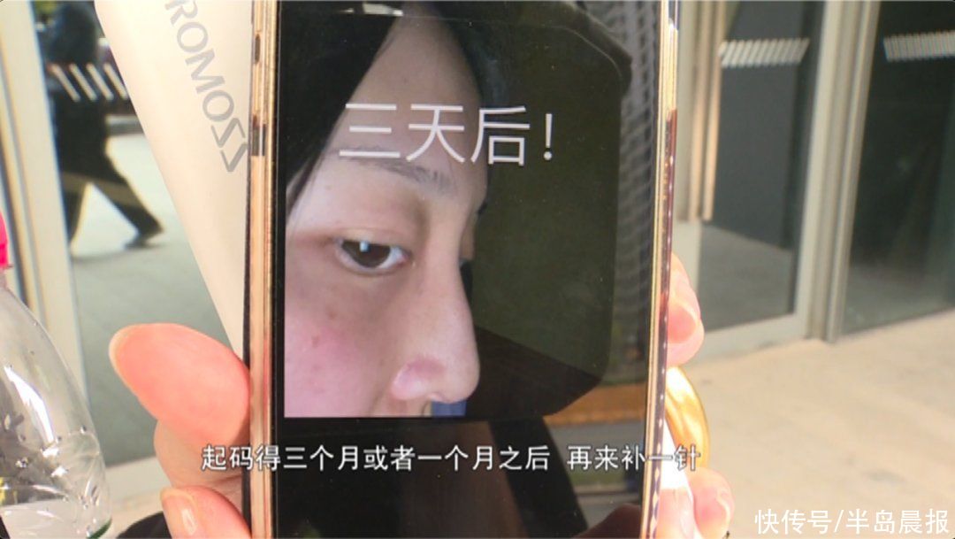 3天就变回原样！女子花高价注射玻尿酸，结果却入了个“无底洞”
