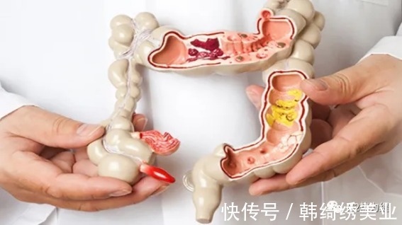 肠道运动|「生命养护」,如何调理亚健康、便秘!