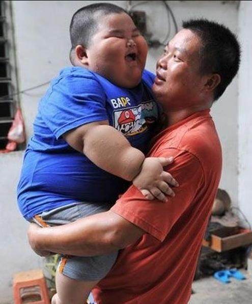 孩童|为何三岁孩童胖成一百五十斤家长说已经成瘾戒不掉!