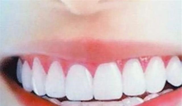 坐月子|她五年内剖腹产4次,还学外国人不坐月子,如今现状怎样了