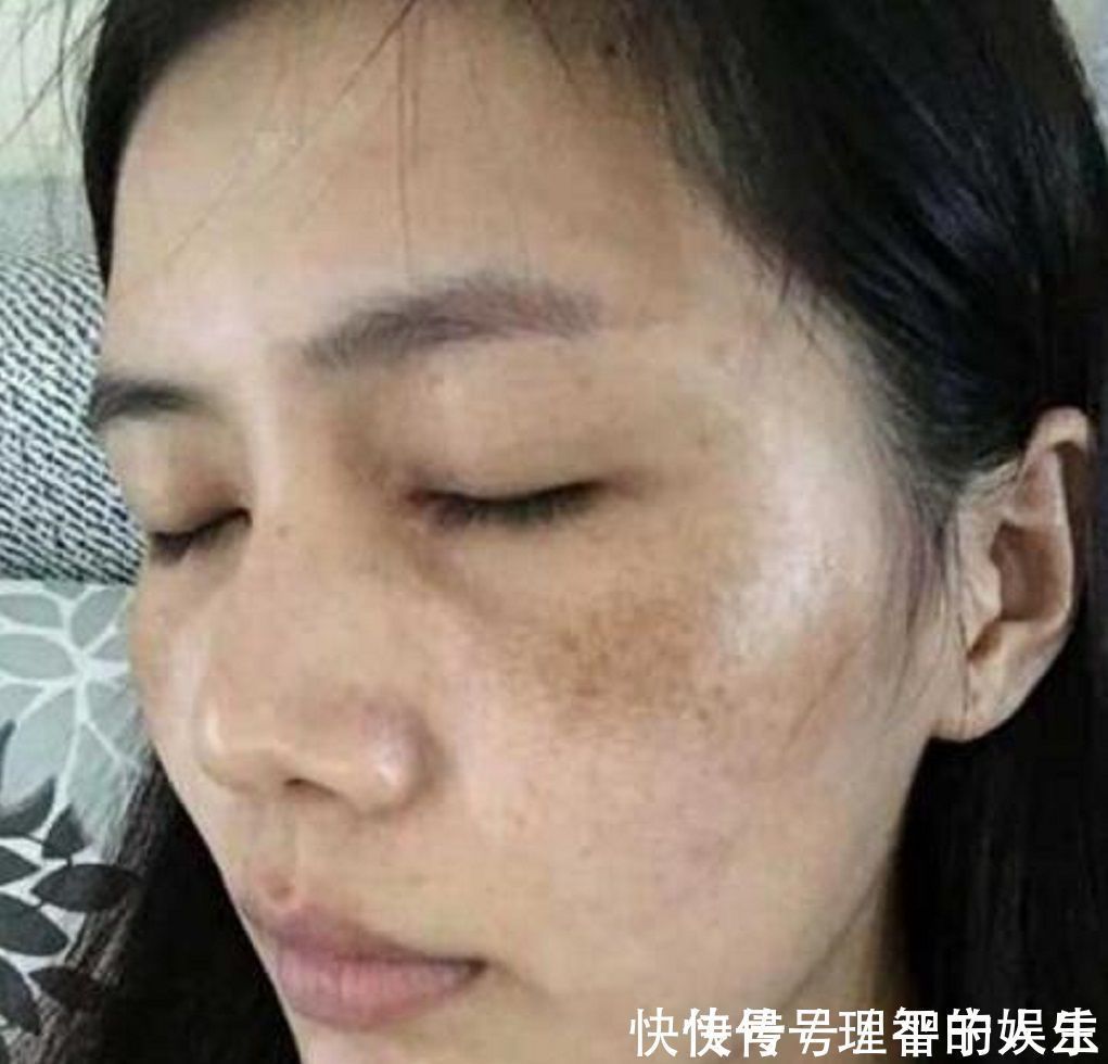 色斑妹子别乱花钱了,用酸奶加它敷脸,美白嫩肤又淡斑,值得收藏