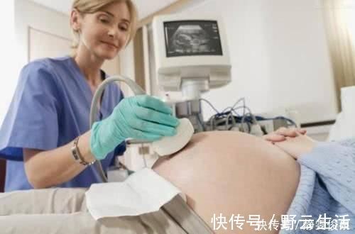 胎儿|孕妇做B超,为什么医生要涂一层黏乎乎的胶体,说出来你可能不信