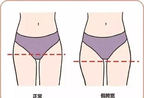 左腿|臀部两侧凹陷？假胯宽？8个美臀瑜伽动作请收藏好！