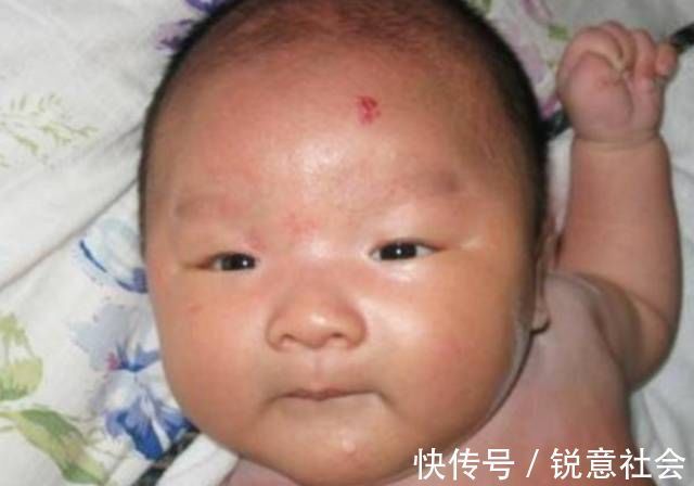 坏习惯|孕妈再不改掉这些“坏习惯”,当心宝宝“胎记缠身”,别再固执了