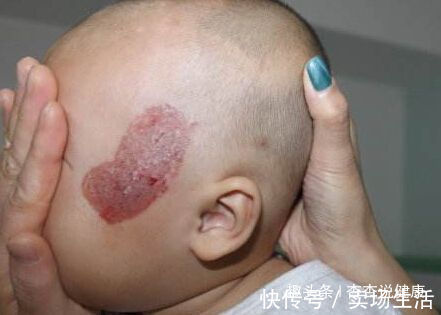 准妈妈|怀孕后,几件事孕妇最好不要干,要不然出生的婴儿可能有胎记