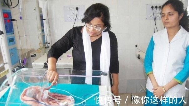 婴儿|女子怀孕10月,生下4手4脚异形婴儿,医生却这样解释!