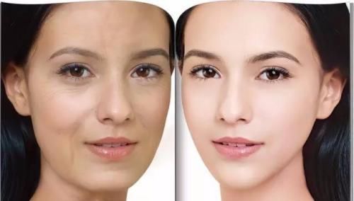 胶原蛋白|当你身体出现了这几种情况，说明身体开始衰老了！