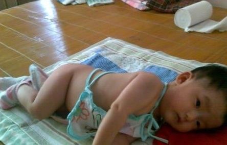 鸡内金|孩子积食再顽固,宝妈用2招,轻松去积食,孩子长大个