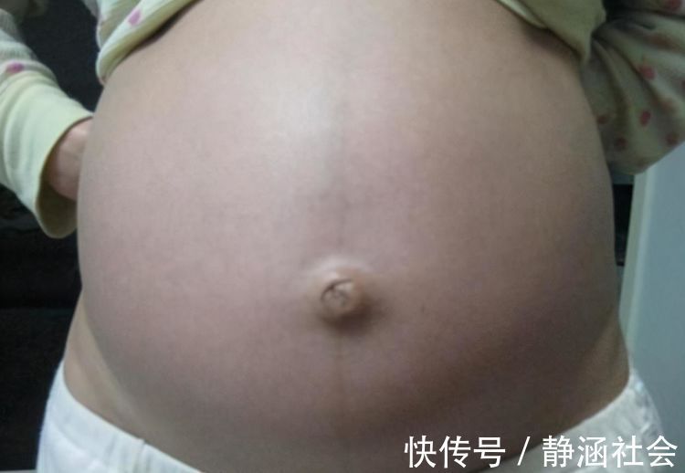 肚子|准妈妈肚皮被“盯上了”，孕肚的几个特点，跟胎宝性别有关吗？
