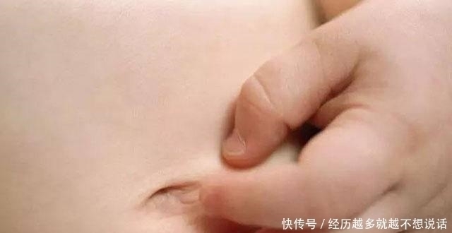 脐带|肚脐眼能不能抠?喜欢抠肚脐眼的孩子,你们知道后果会是怎样吗?