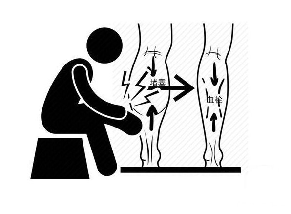 血管堵塞|深受血栓“偏爱”的人,有四个共性,若你没有,说明血管还不错