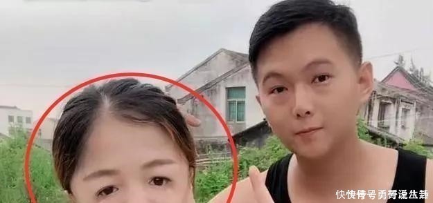 “鸟脸”妈妈不顾劝阻生二胎，二宝没躲过遗传，是任性还是母爱