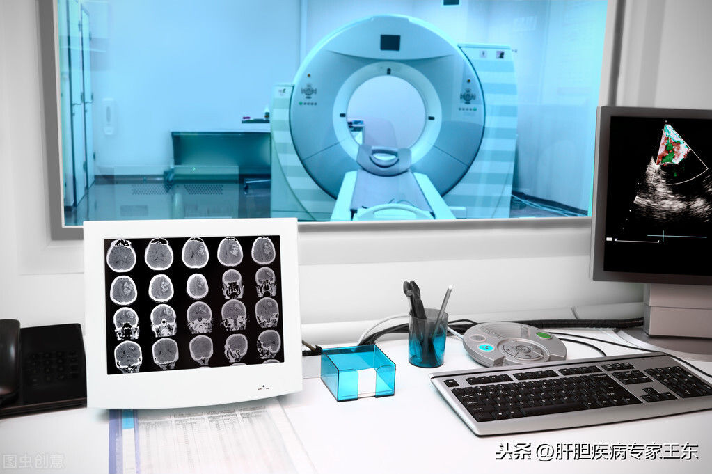 结直肠癌|已经诊断是“肝癌”了，为什么医生说还要做检查？