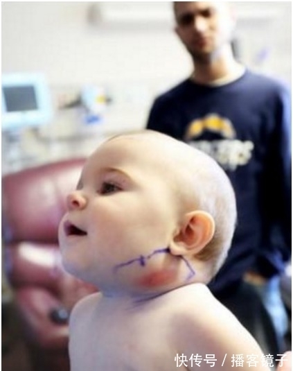 红肿|父母带着脖子突出一根东西的女婴去医院 一往外拉连医生都吓傻