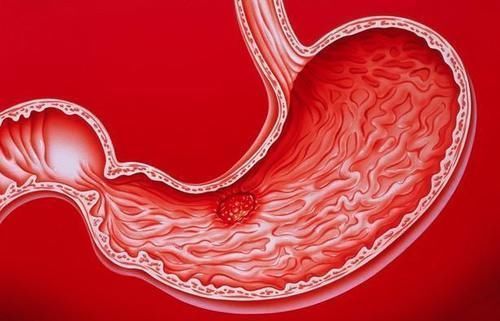 本草纲目|养胃“冠军”找到，不是小米和南瓜，常吃赶走幽门菌，胃病绕着走