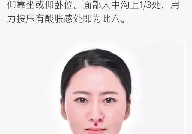 奇穴妙用(五)人中、委中穴-急性腰痛特效穴