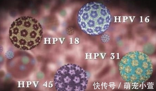 上门|90后情侣感染hpv,医生提醒:男女身上2处“长痘”,或是hpv找上门