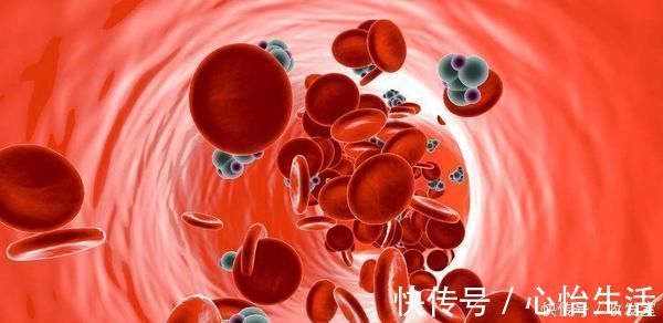 高血脂患者|高血脂患者吃什么好?医生整理了7种食物,排第一的竟不是山楂