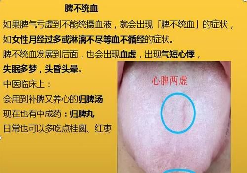 神疲乏力|脾气虚、脾阳虚，这6种脾虚，从初级到严重，你是属于哪一种？