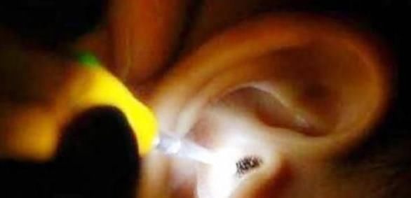 鸡皮疙瘩|4岁男孩说耳朵痛,医生拿灯光一照,鸡皮疙瘩起了一身
