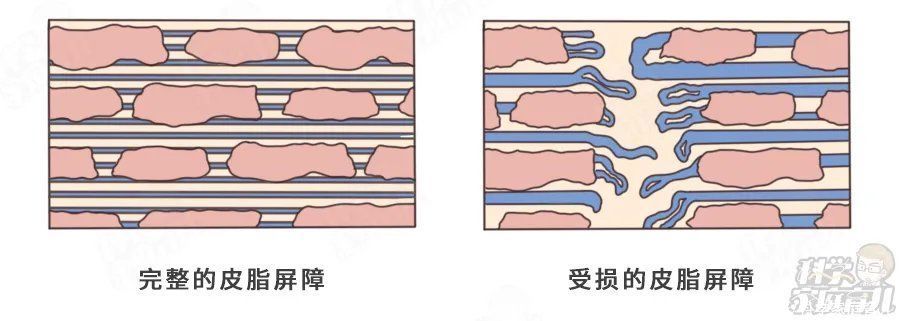 湿疹|紧急提醒！湿疹娃打疫苗后意外致死！60%湿疹，不要用药