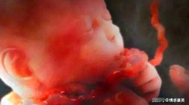 晓雪|怀孕几个月容易脐带绕颈? 牢记这些症状, 孕妈别疏忽