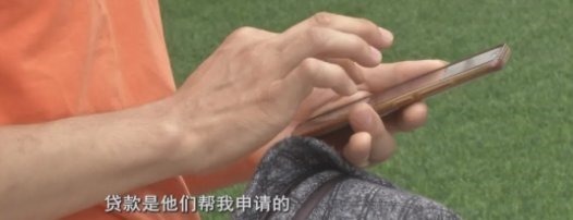 门诊部 男子去植发，15元1根，付款后惊呆了：根本还不起