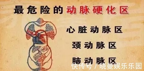 动脉硬化|血管开始变硬，腿脚先知道？若占3个以上表现，尽快去医院检查