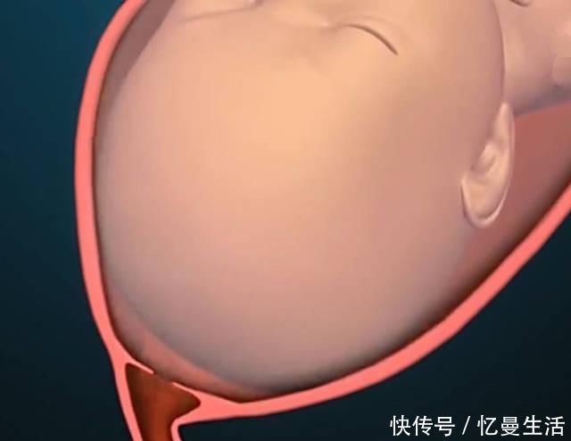 宫口|顺产到底有多“疼”看到第3张图,也许你会明白