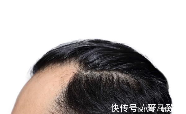 变老|男人开始变老,晨起一般会有这5个共性若出现3个,衰老即将开始