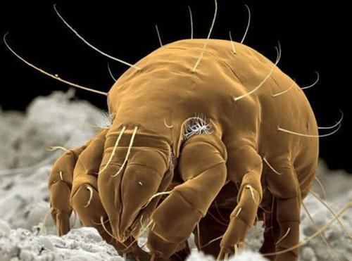 头发上“白泥”增多,或是“它”在作祟,做好4件事,慢慢减少