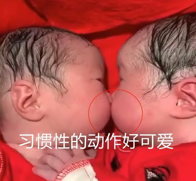 陪伴|龙凤胎兄妹刚出生就一直亲,护士刚分开,又抱到了一起,暖心