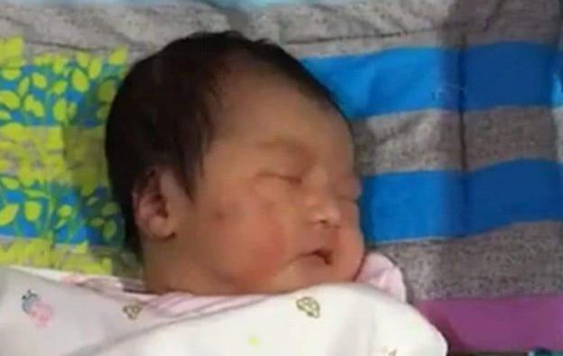 死亡|孕妇破水15小时,生产后娃“意外”死亡,家属孩子是被产钳夹死