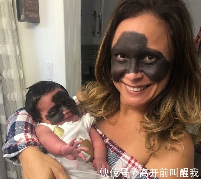 面具|7个月婴儿脸上因巨大黑色胎记爆红!像带着“蝙蝠侠”面具!