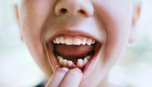 常识|孩子脱落的乳牙真能救命?看看权威机构的说法:这些常识父母要知