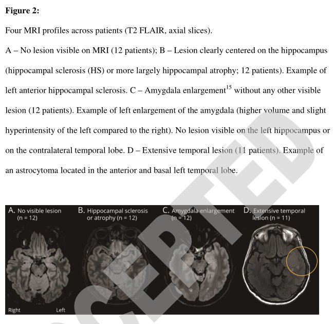 患者|Neurology：已证实！颞叶癫痫患者主观记忆抱怨背后，客观记忆缺陷确存在