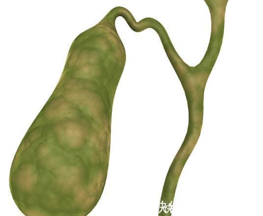 腺瘤性息肉|四部分的息肉,最好及时切除,癌症可能会出现很长一段时间!