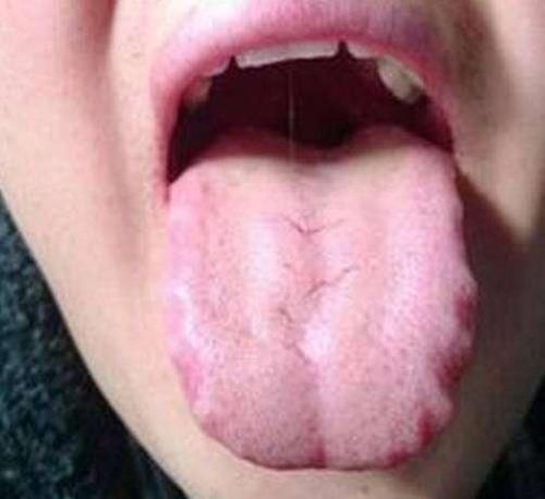 老中醫(yī)|老中醫(yī)祖?zhèn)黛钛鄞胤?每天喝點它,只需十天,眼袋去無蹤