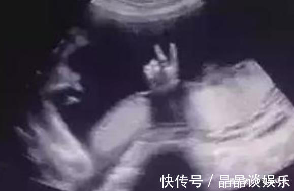 宝宝|9个月胎儿在肚子里的萌表情,你见过几个,医生现在孩子成精了