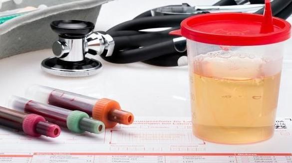 小事|肾病没有未来,只能等尿毒症,只要坚持3小事,肾衰竭不会轻易来