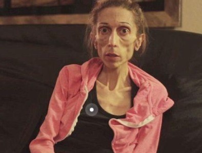 癌细胞|为什么“癌症”喜欢瘦子，胖子和“它”无缘可能看完你就明白了