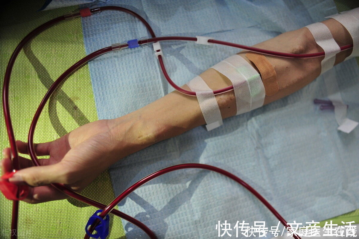 尿毒症患者|得了尿毒症没有多少天可活?别自己吓自己!坚持做好这4点,可延长生命