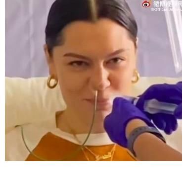 结石|Jessie J 更新病情,没有一天不痛,结石姐这些年,真让人心疼