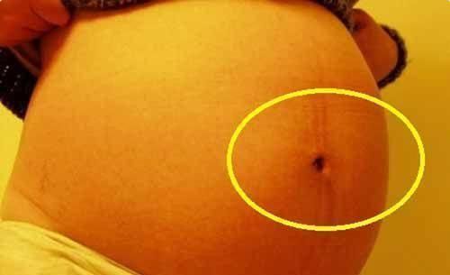 孕晚期|孕妈肚脐凸比凹好?别自己吓自己,区别倒是有,真相孕妈要了解