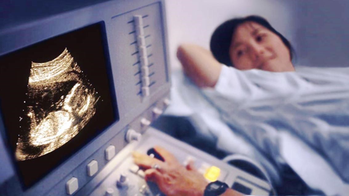 畸形|高龄产妇生下“猪八戒”宝宝,丈夫不想抚养,医生的解释挽救了娃