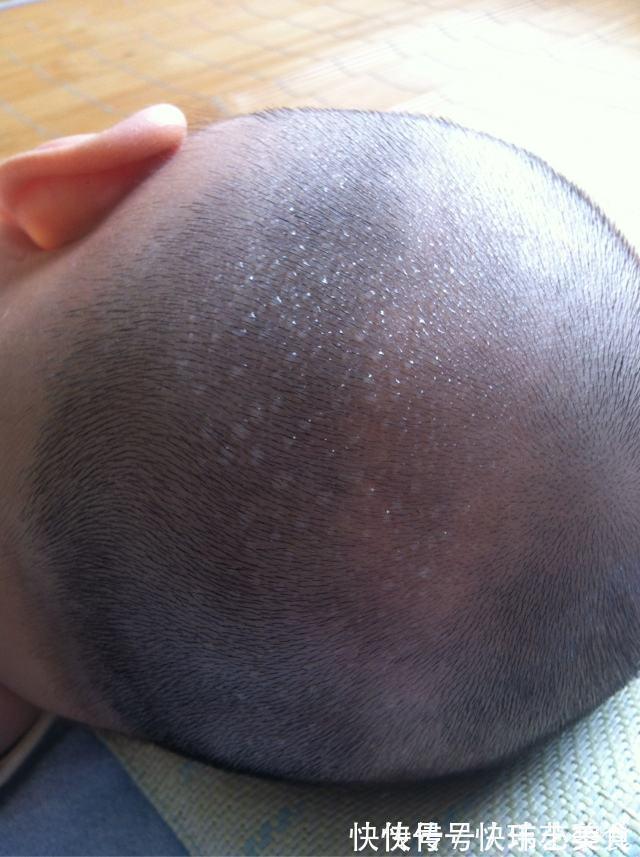 宝爸|孩子睡着就满头大汗,是缺钙吗?真相没那么简单,爸妈要当心