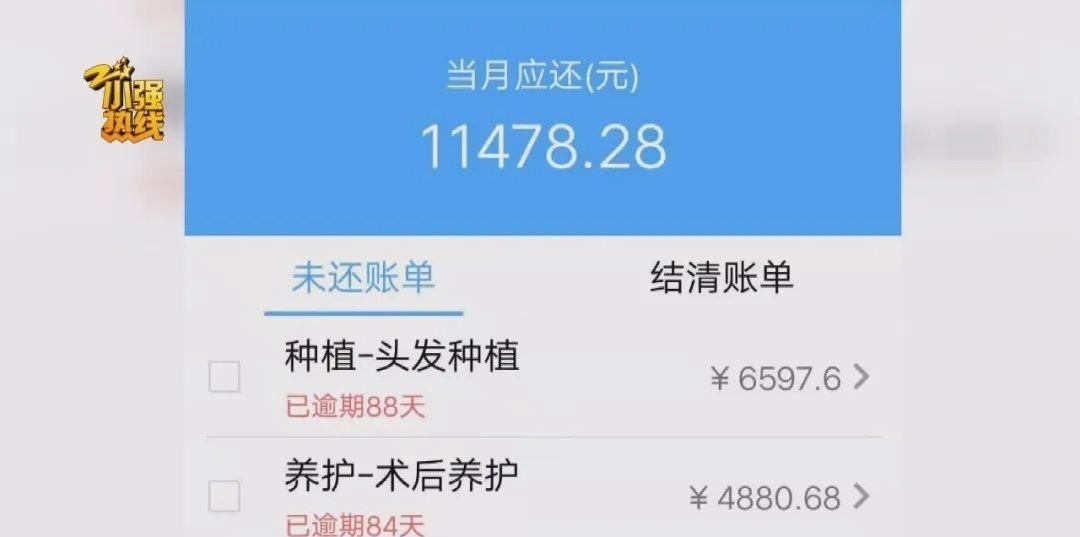 门诊部 男子去植发,15元1根,付款后惊呆了:根本还不起