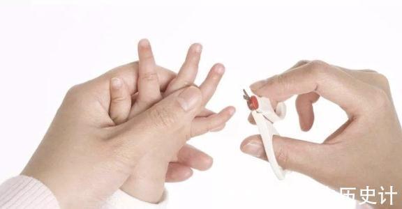 脆弱|从宝宝指甲能看出健康程度?这些宝宝的指甲问题该如何处理?