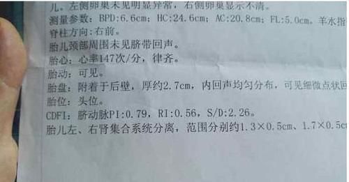 秘密|产检时,孕妇若发现3个“信号”,或许胎宝的“秘密”藏不住了